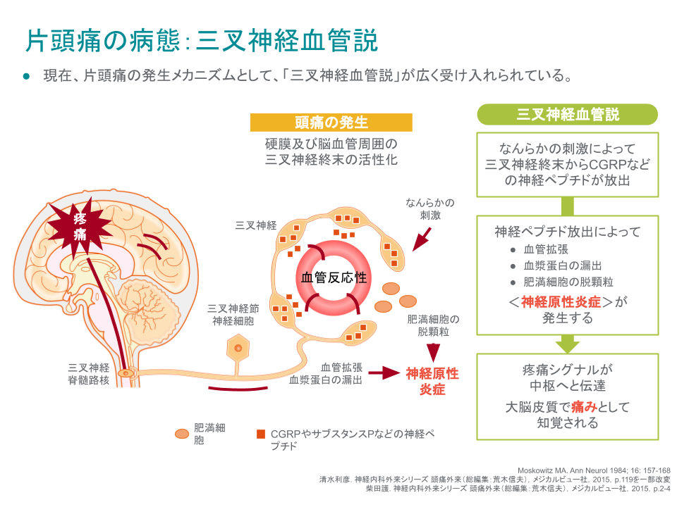 他にPCOSと片頭痛を結びつけるものは何でしょうか?